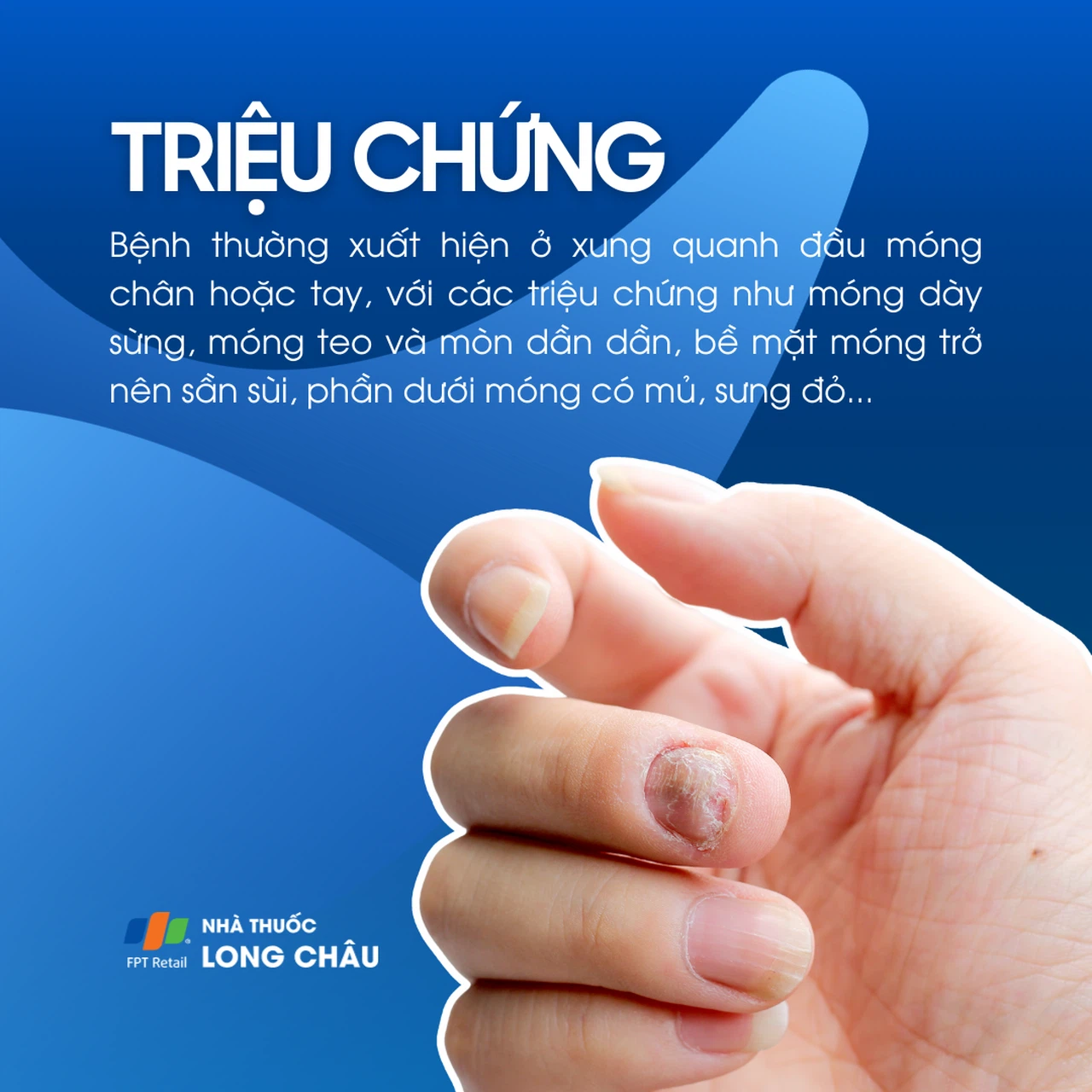Nấm móng 2