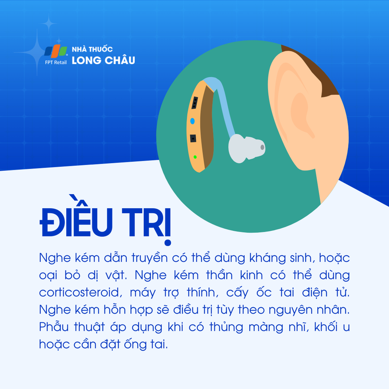 Nghe kém 6