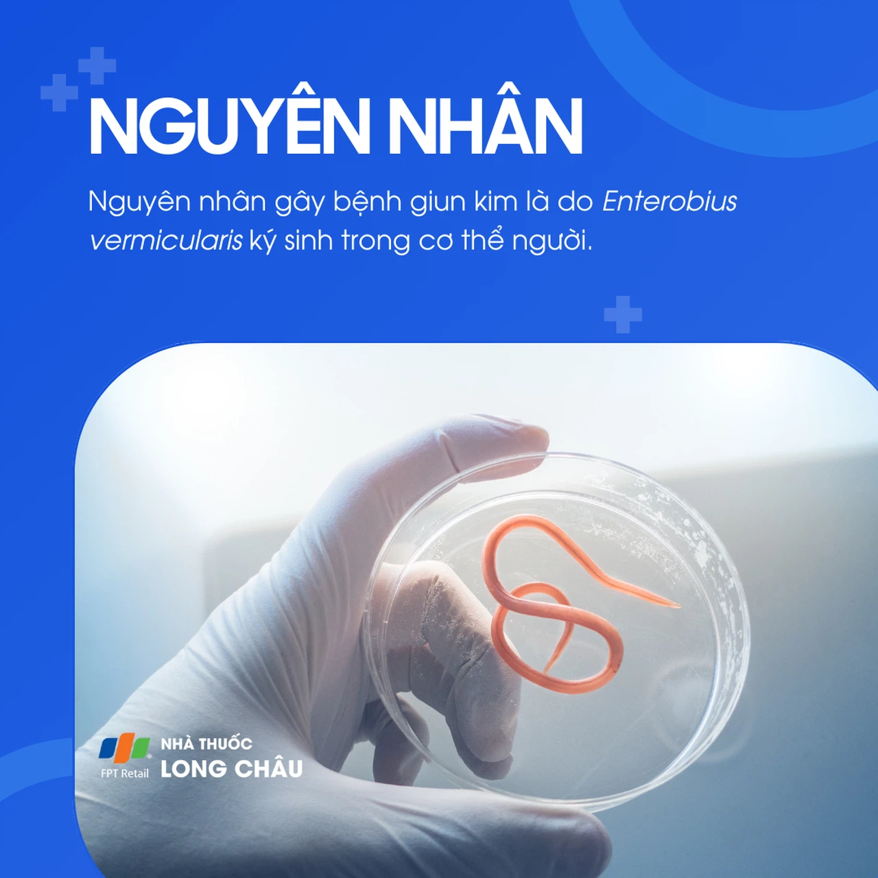 Nhiễm giun kim 3