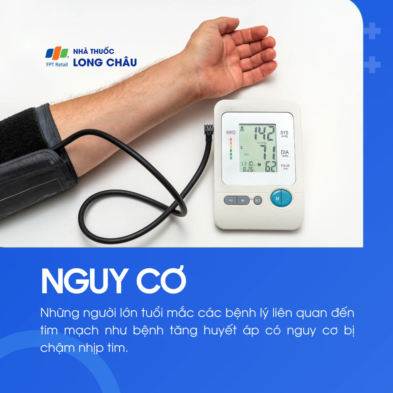 Nhịp tim chậm 4