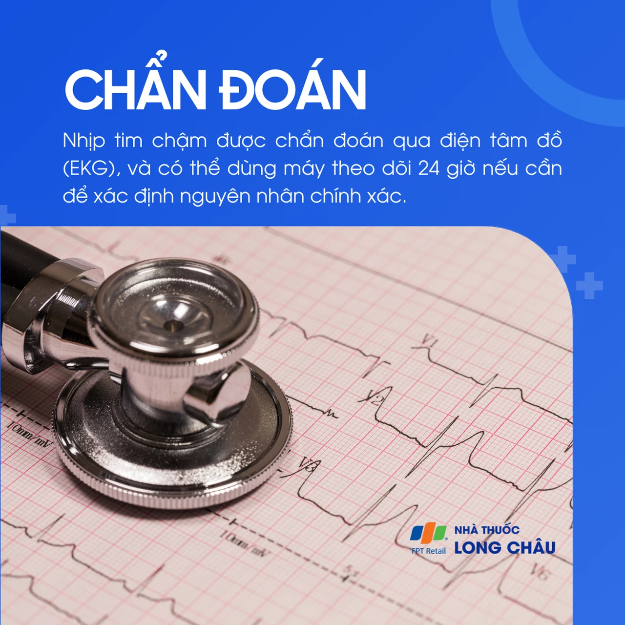 Nhịp tim chậm 5