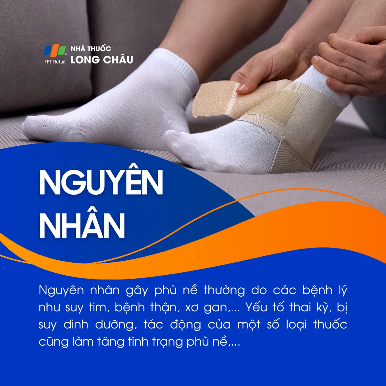 Phù nề 3