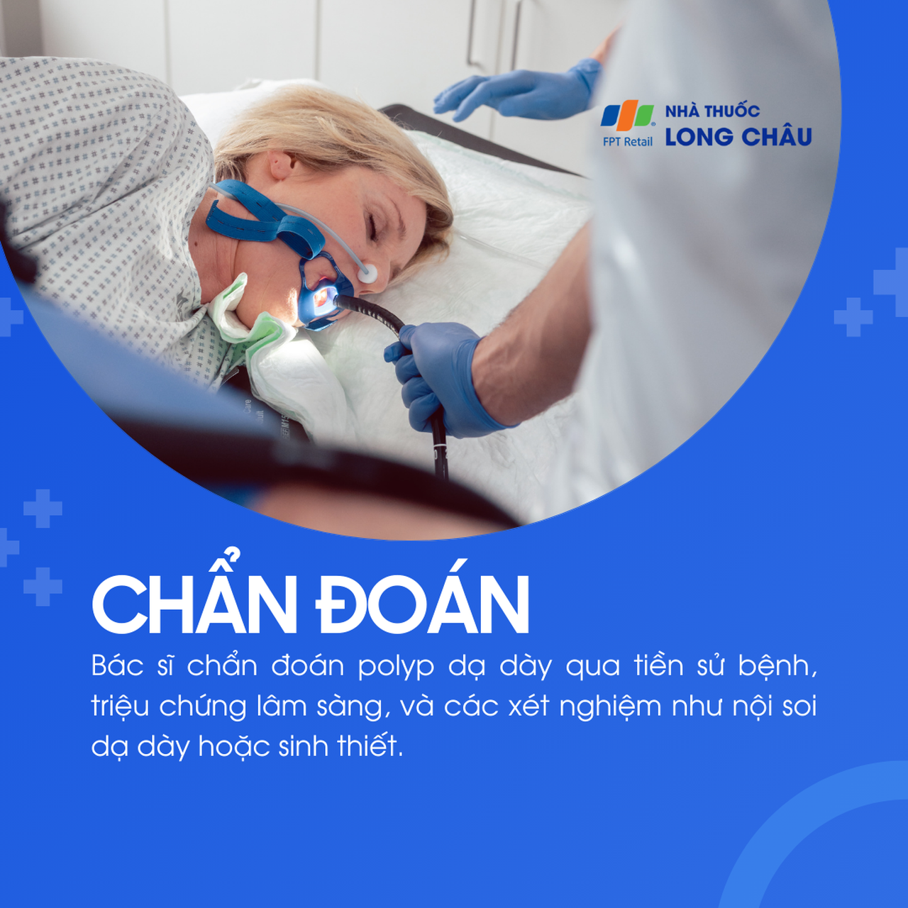 Polyp dạ dày 5