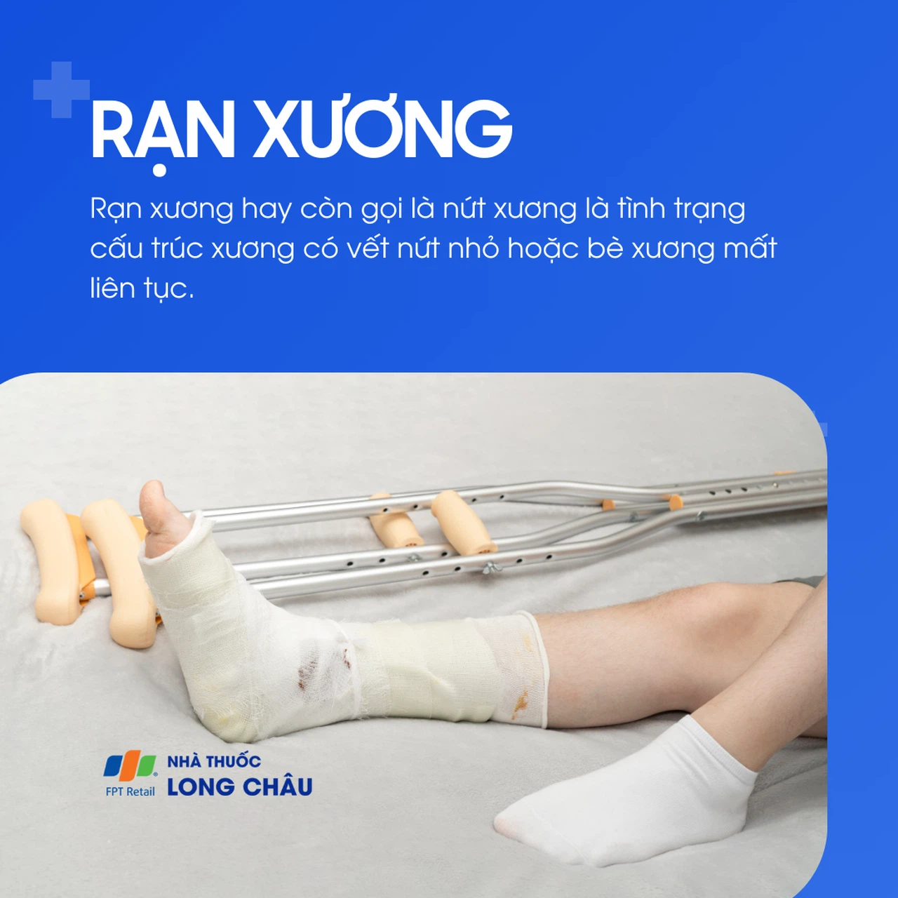 Rạn xương 1