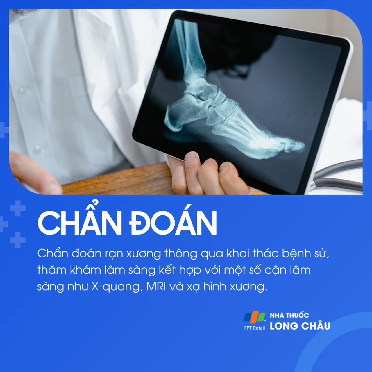 Rạn xương 5