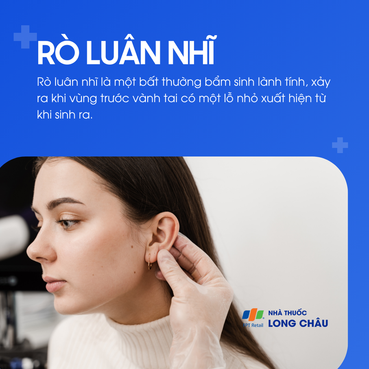 Rò luân nhĩ 1