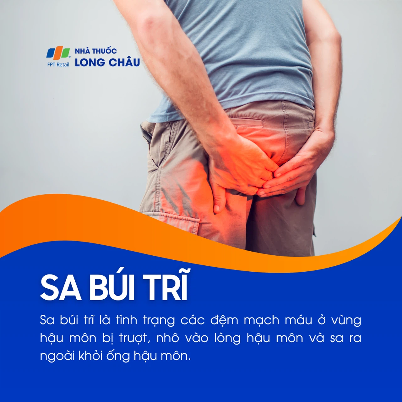 Sa búi trĩ 1