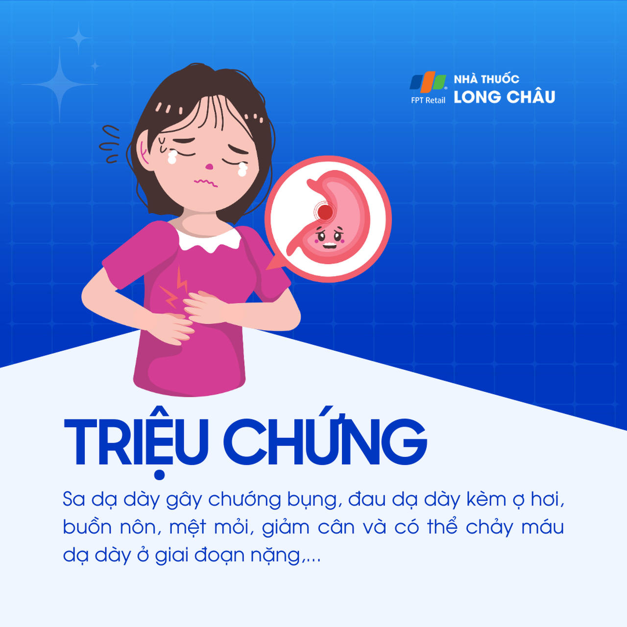 Sa dạ dày 2
