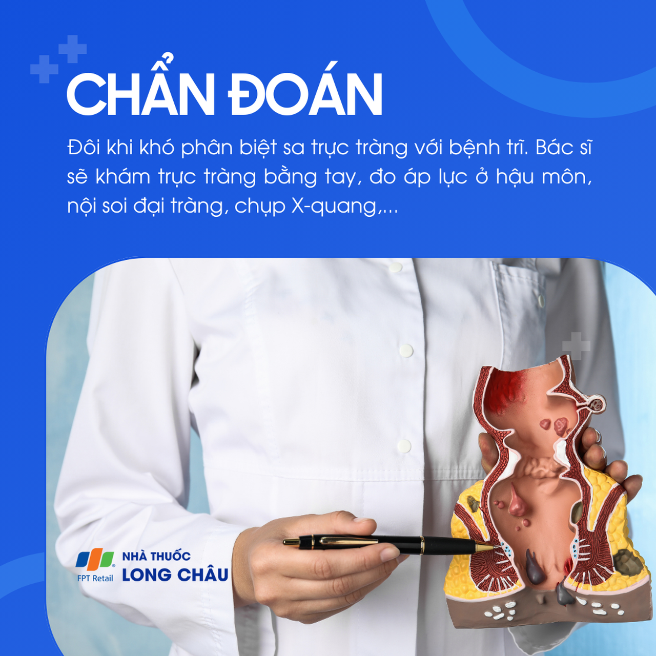 Sa trực tràng 5
