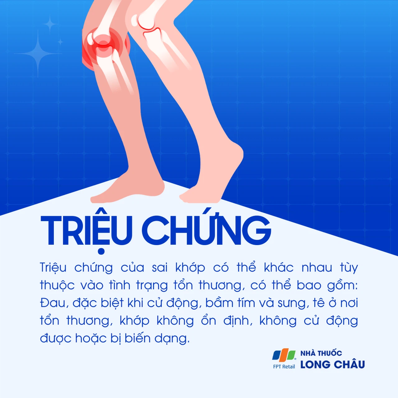 Sai khớp 2