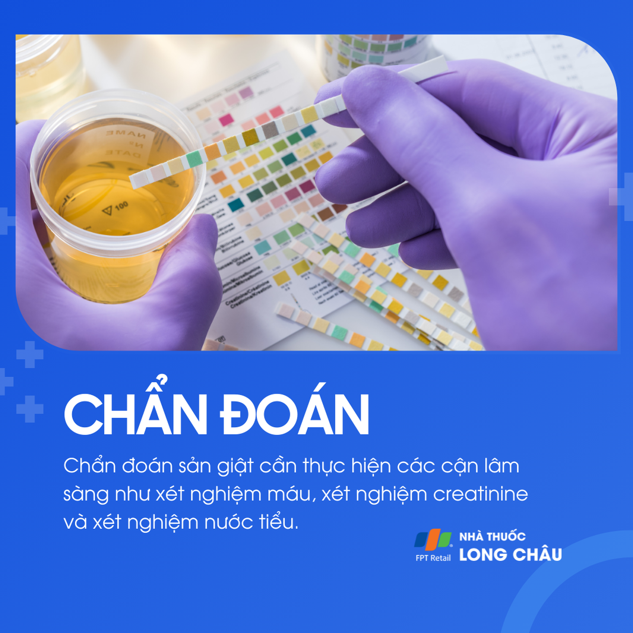 Sản giật 5