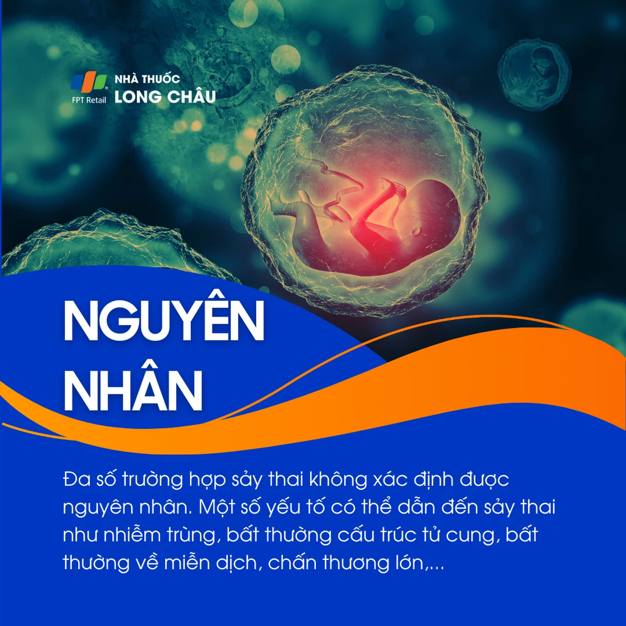 Sảy thai 3