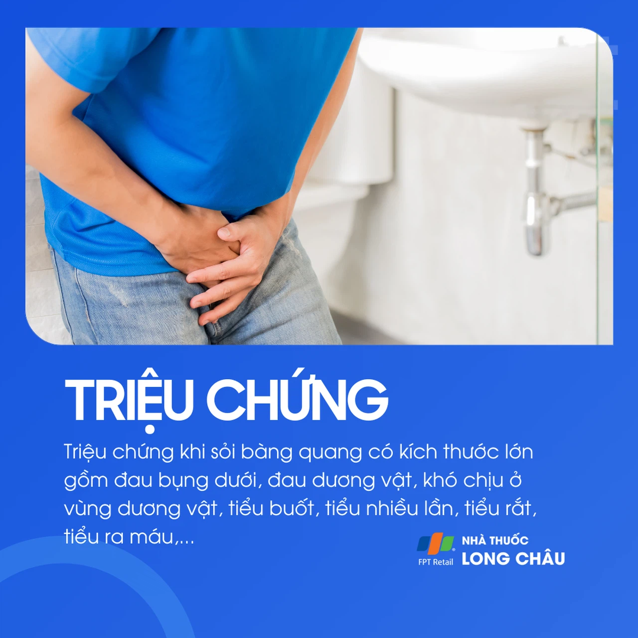 Sỏi bàng quang 2