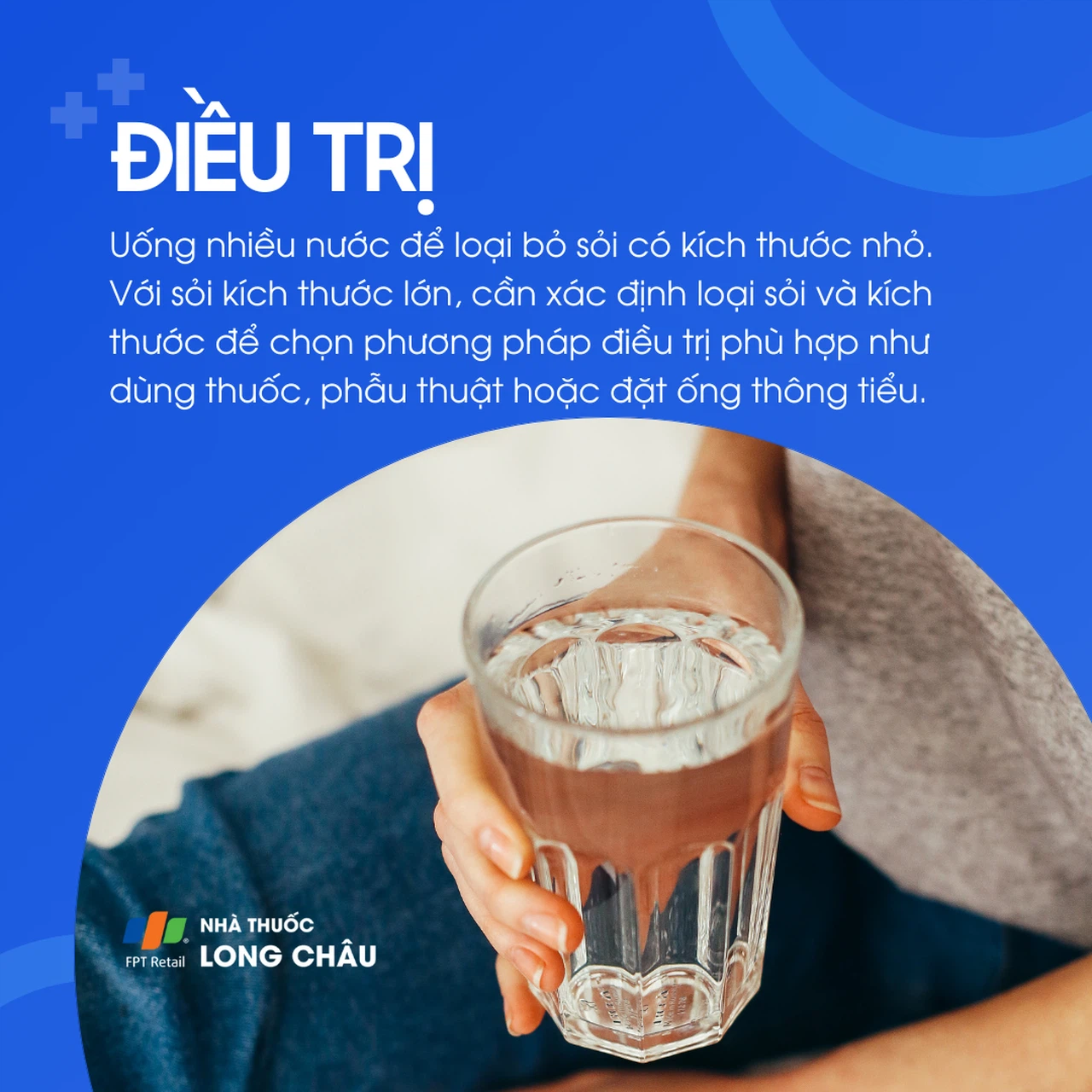 Sỏi bàng quang 6