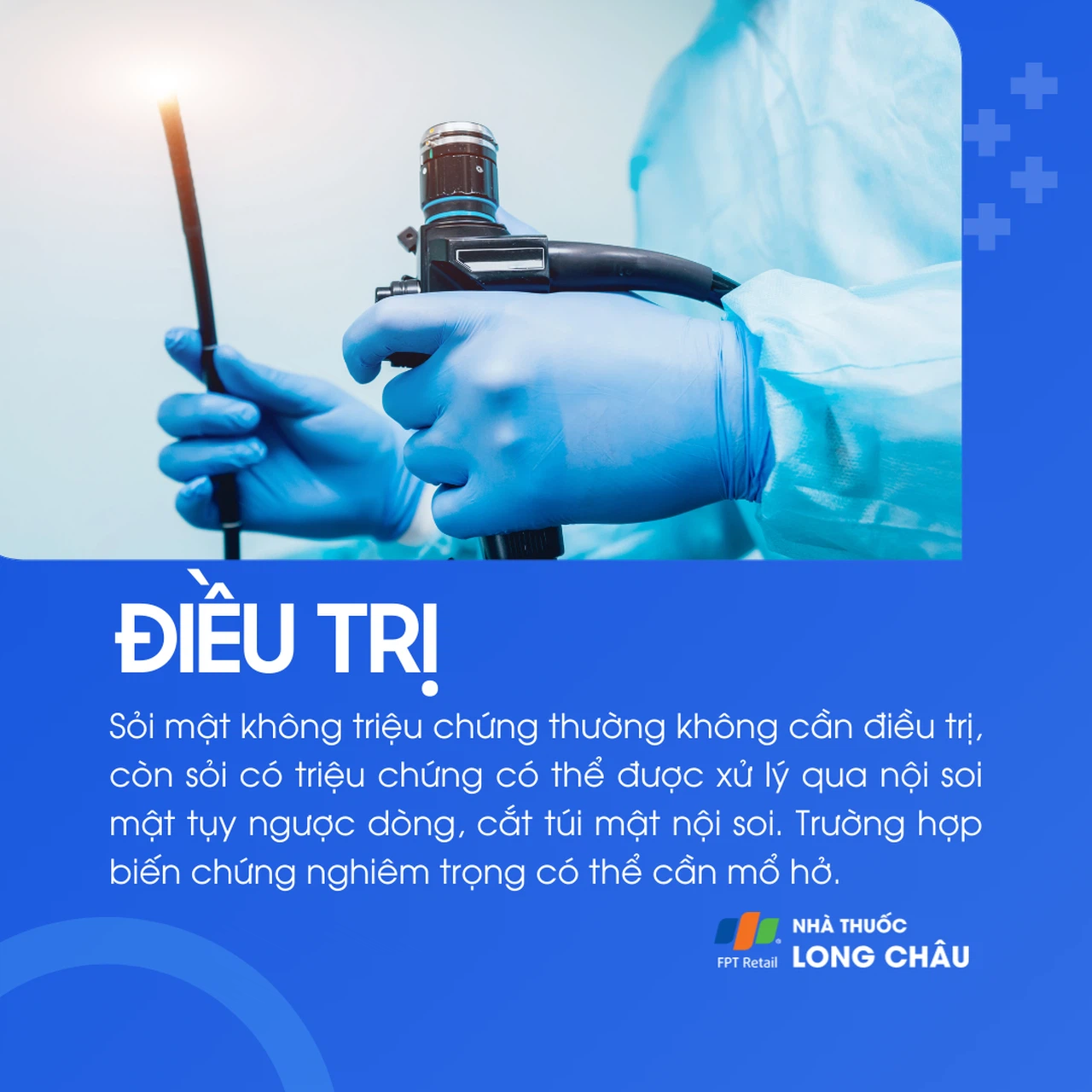 Sỏi mật 6