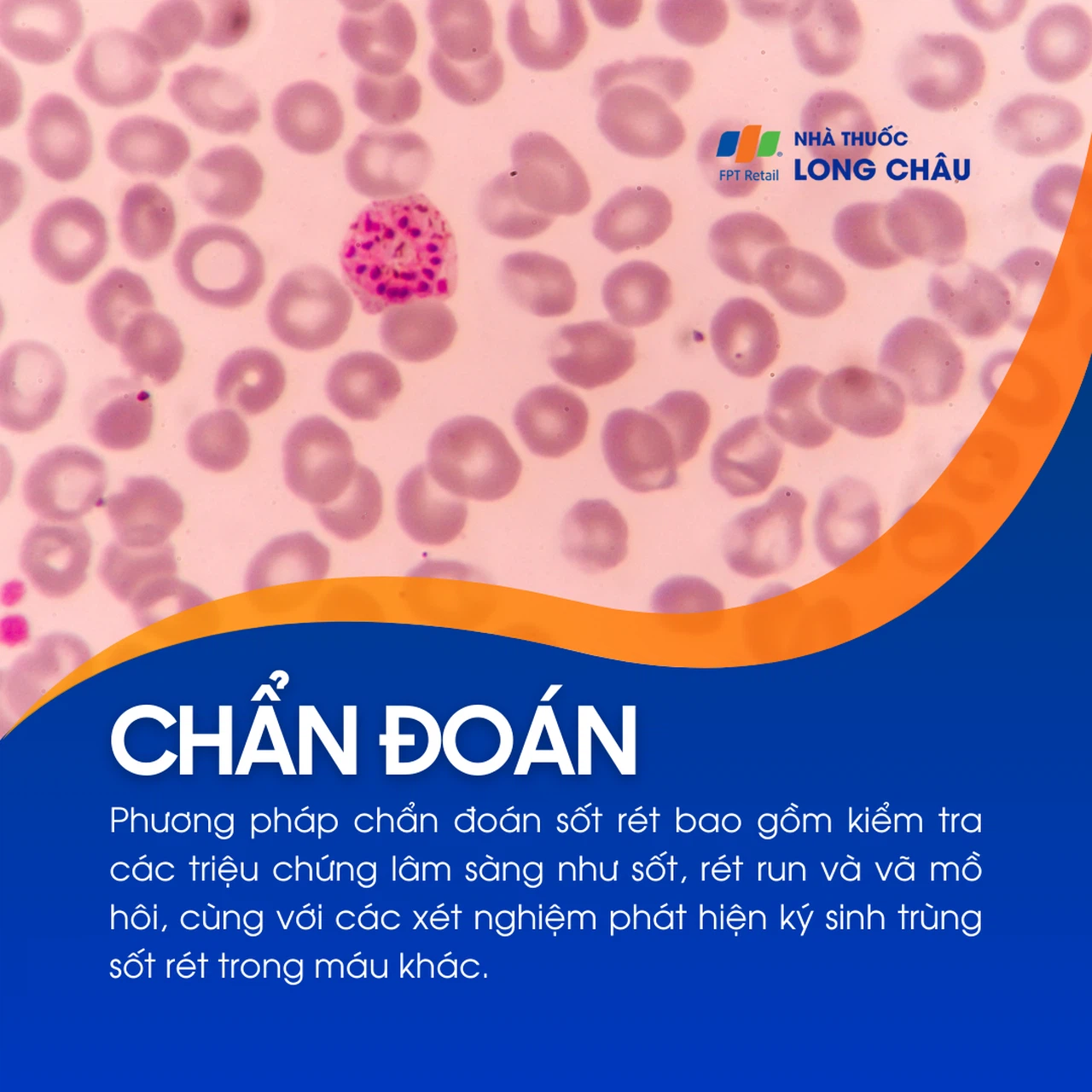 Sốt rét 5