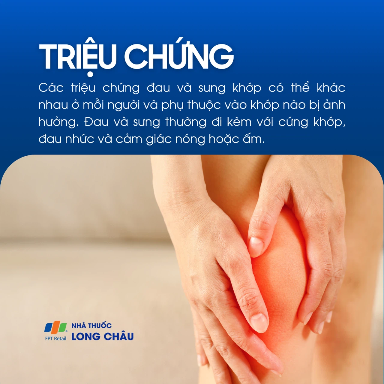 Sưng khớp 2