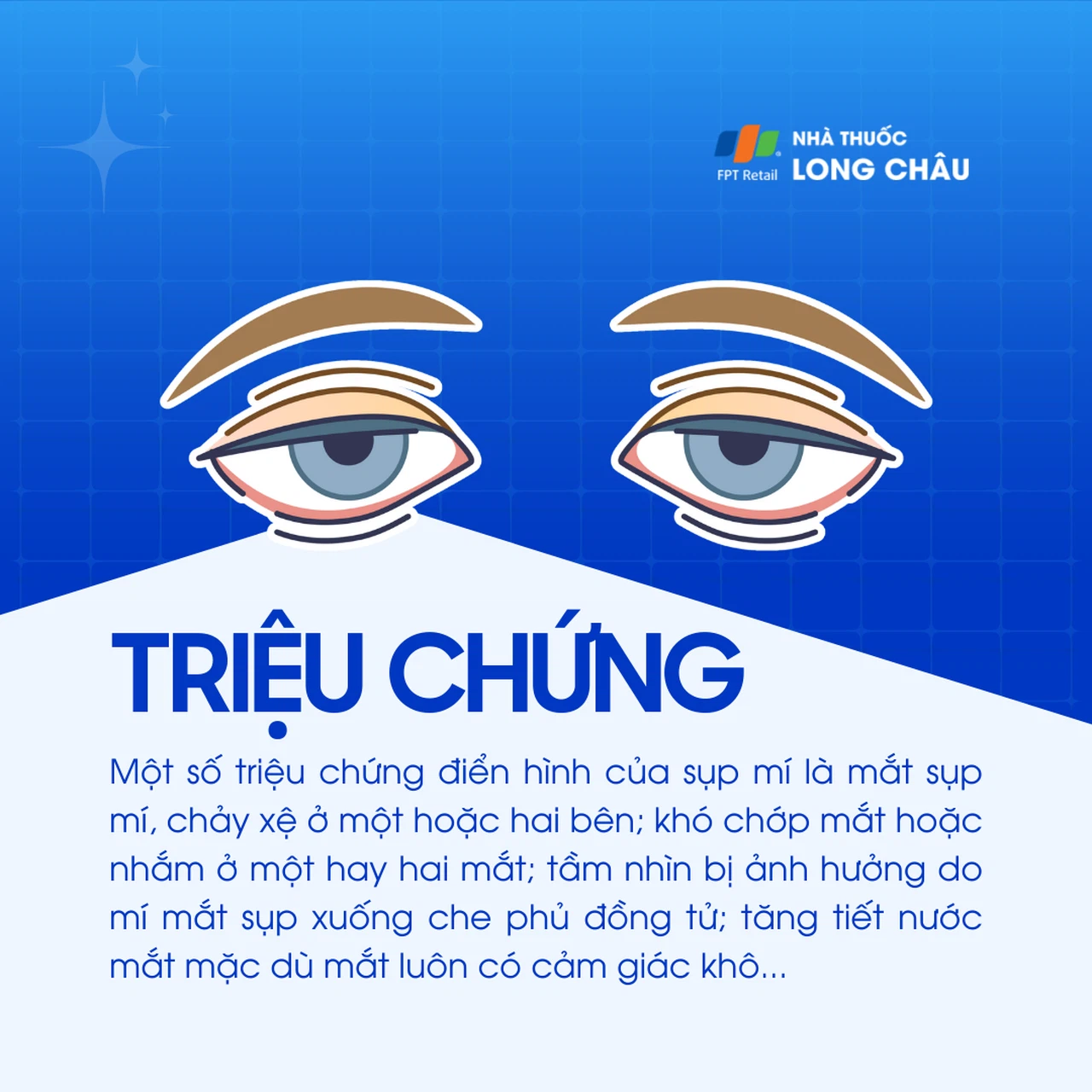 Sụp mí 2