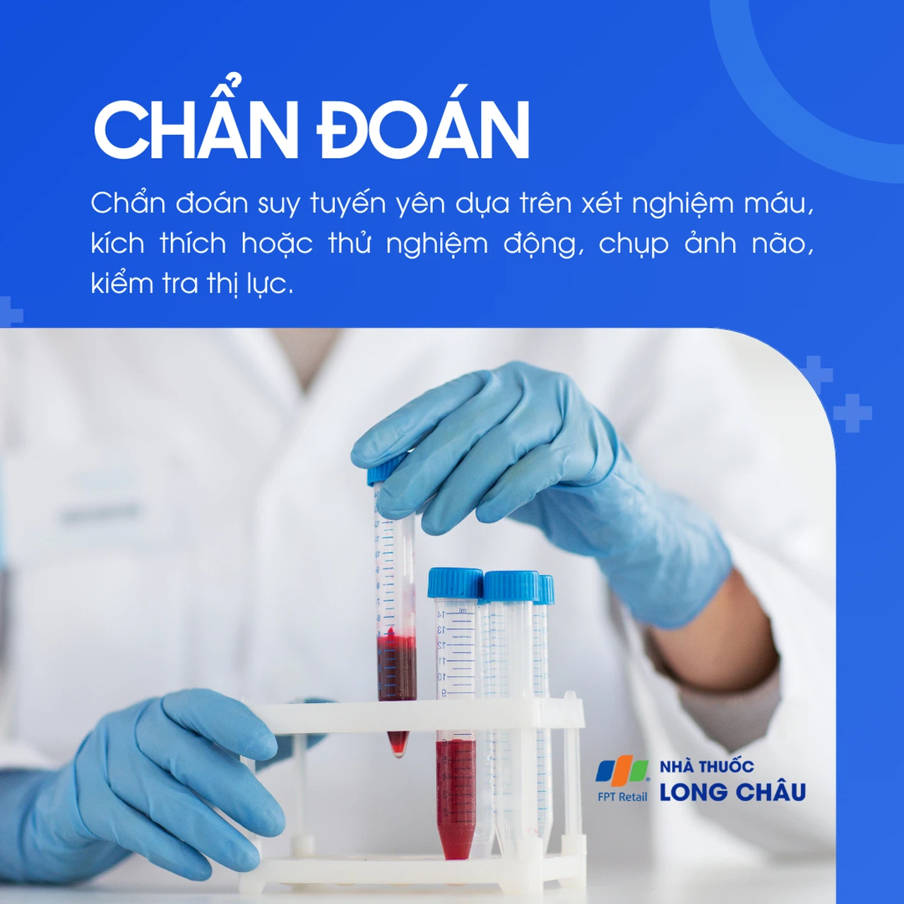 Suy tuyến yên 7