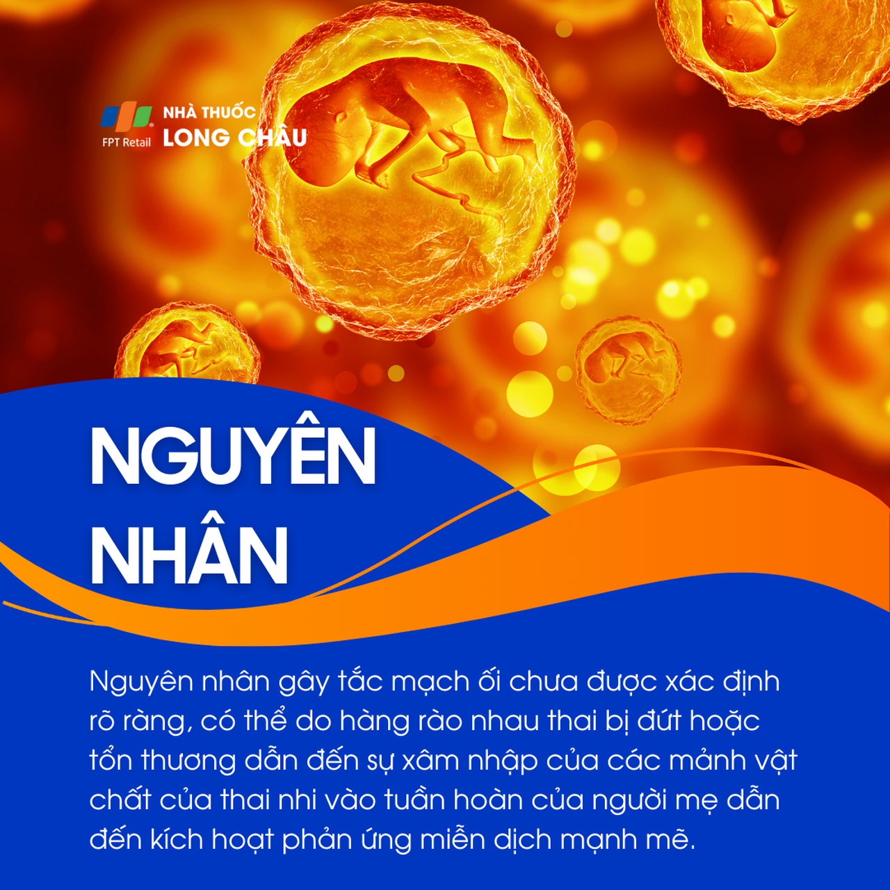 Tắc mạch ối 3