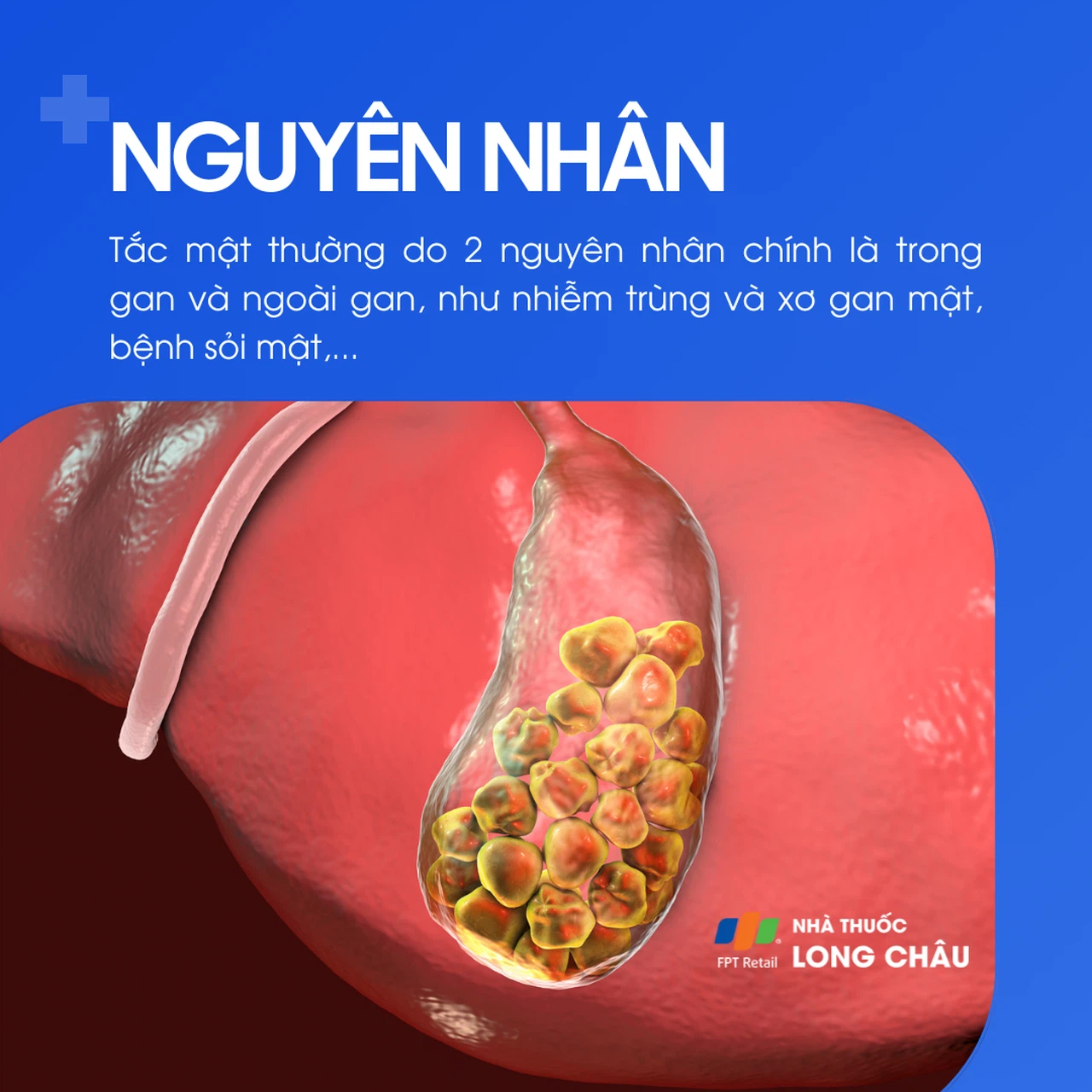 Tắc mật 3