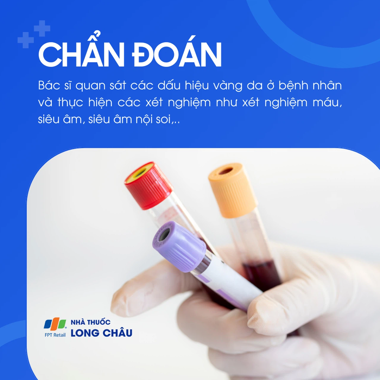 Tắc mật 5