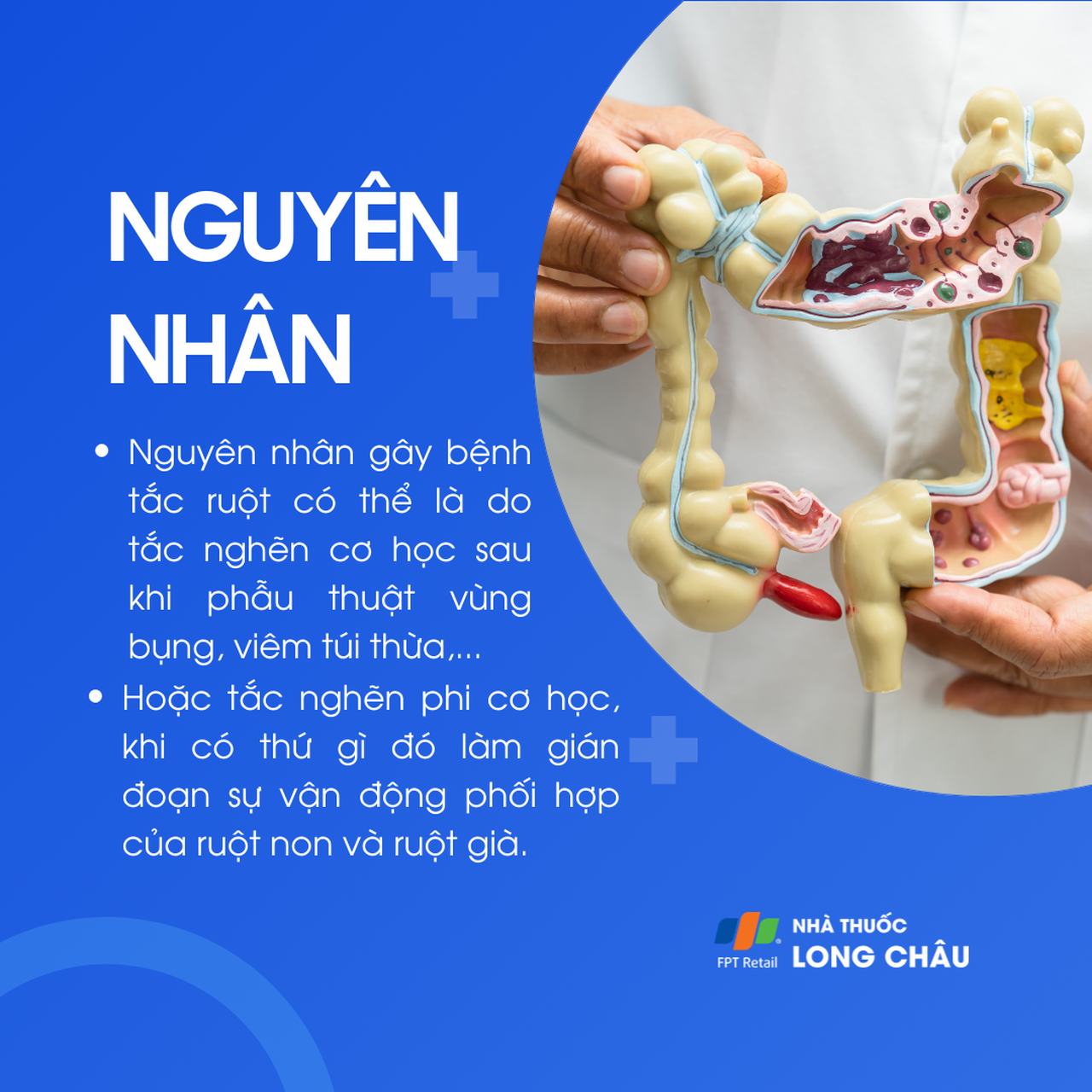 Tắc ruột 3