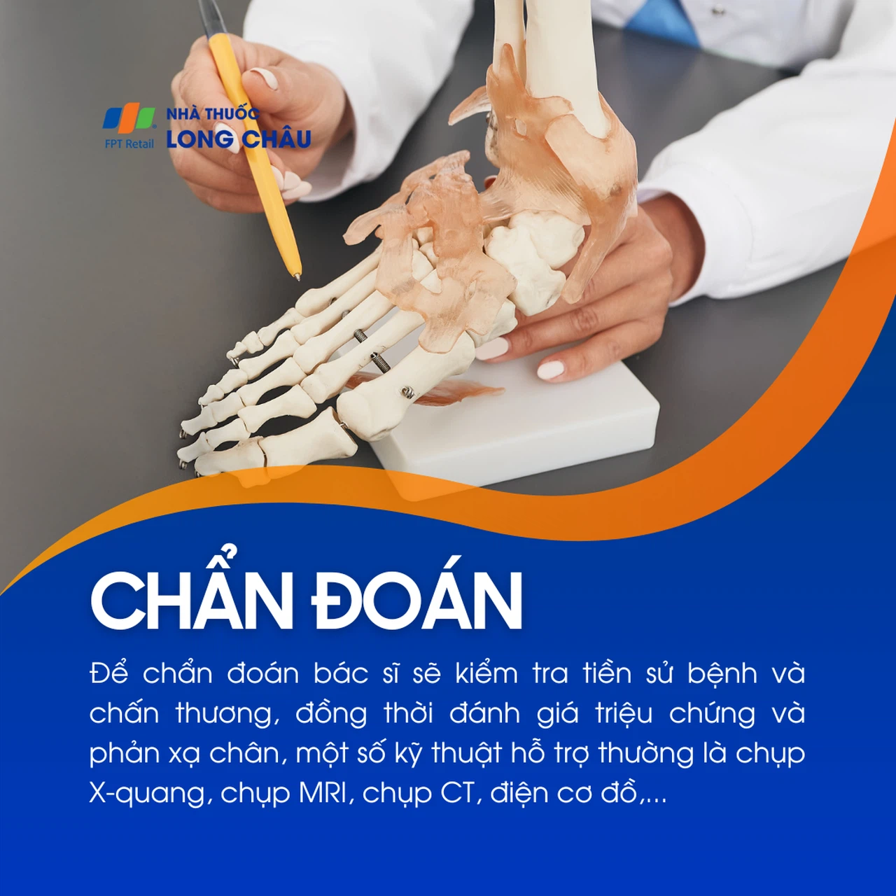 Tê chân 5