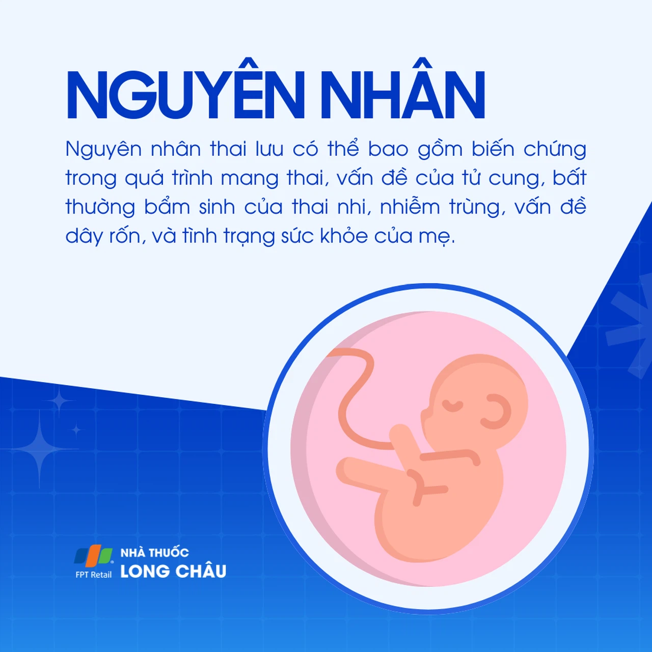 Thai chết lưu 3