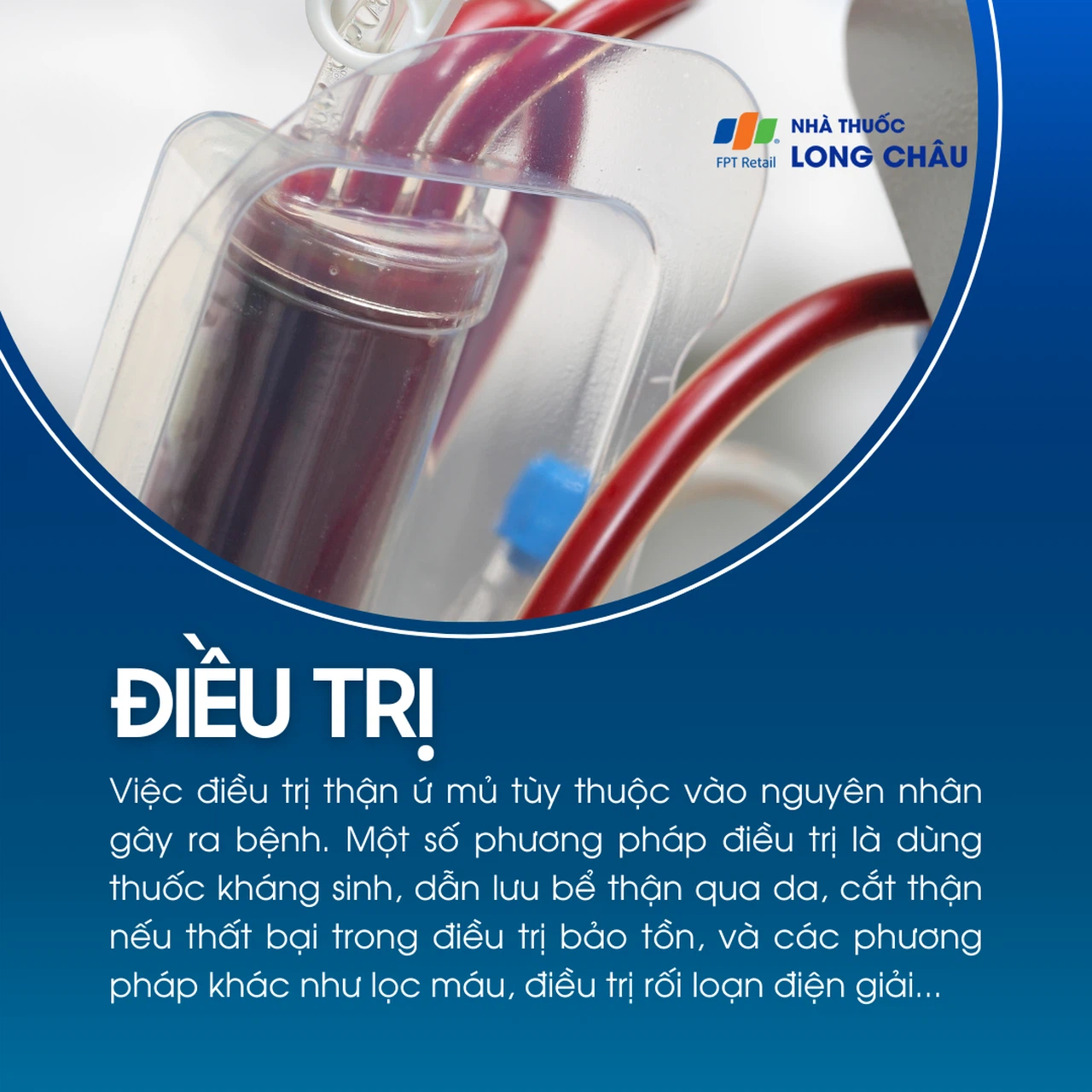 Thận ứ mủ 6