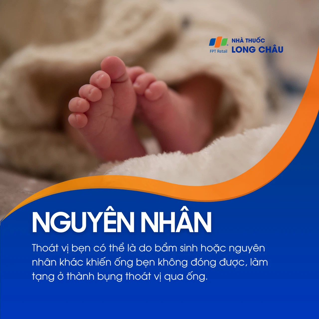 Thoát vị bẹn 3