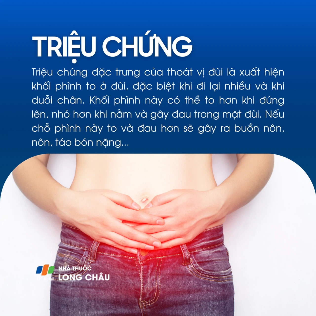 Thoái vị đùi 2