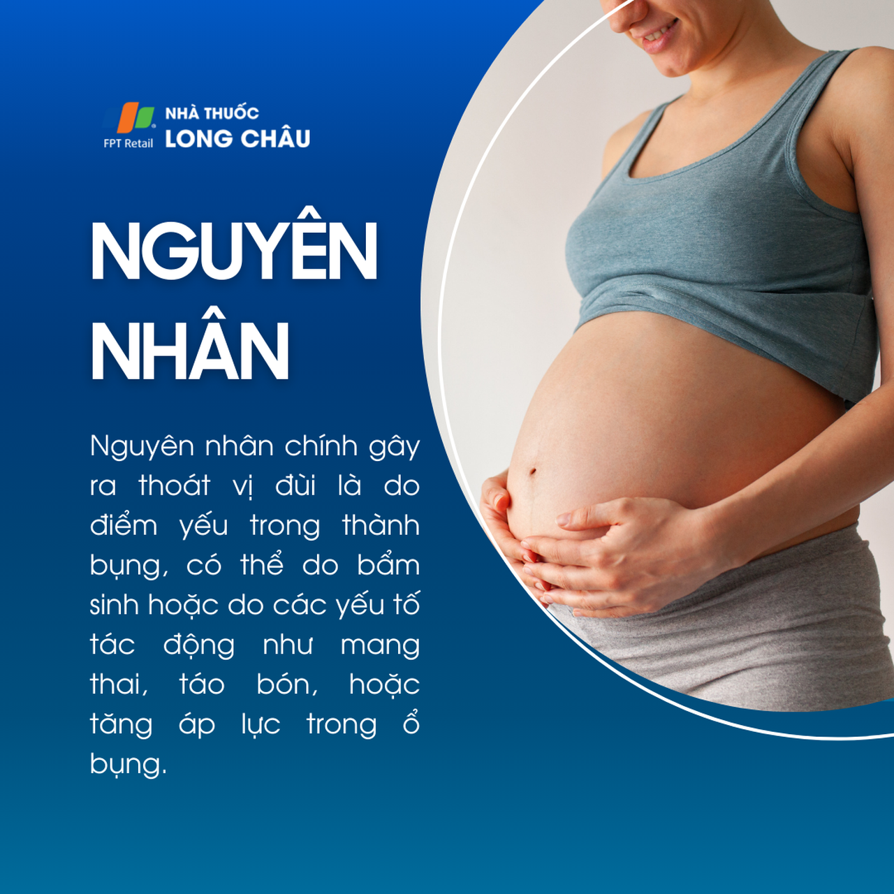 Thoái vị đùi 3