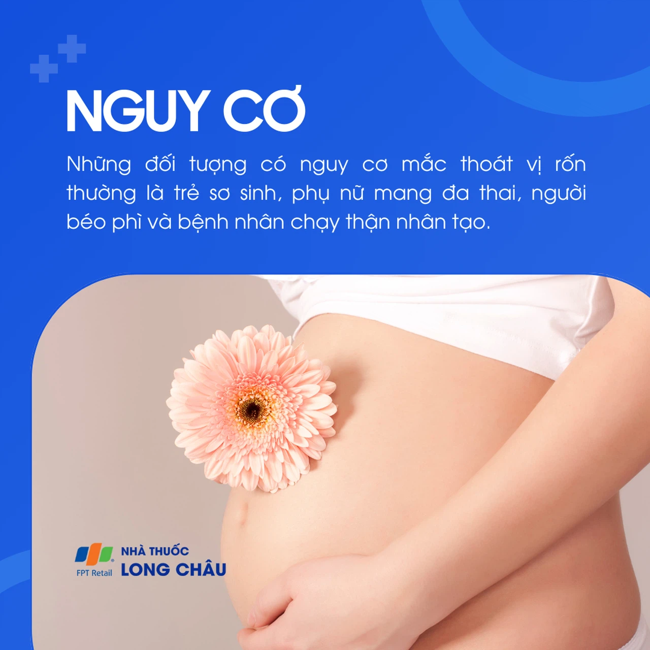 Thoát vị rốn 4