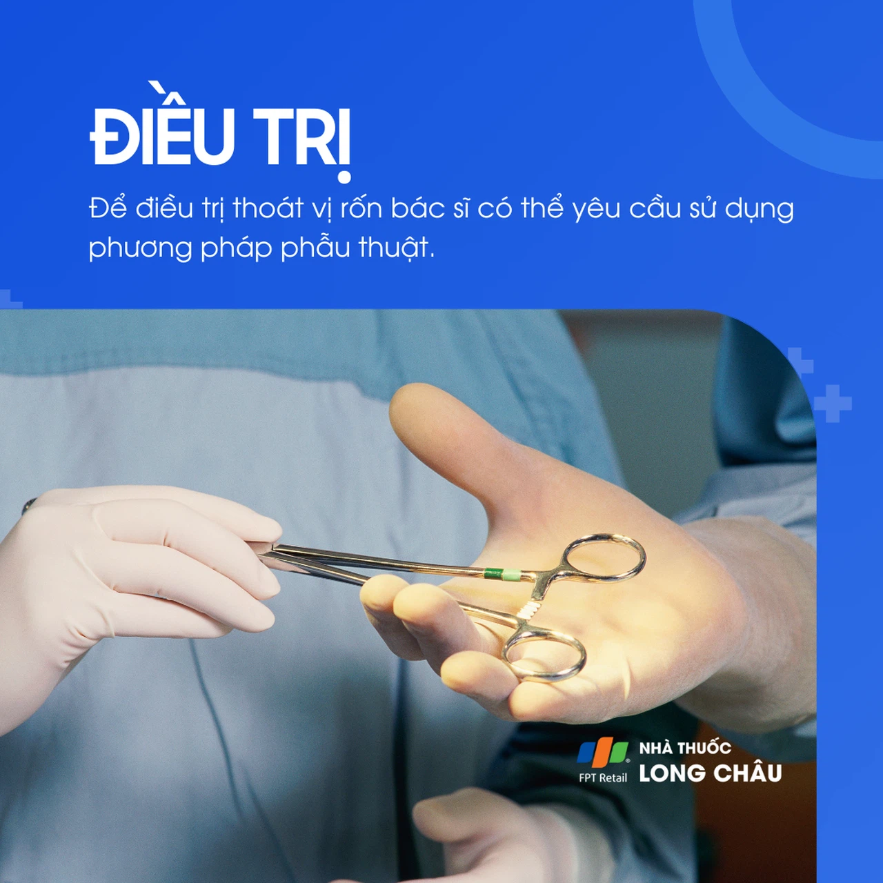 Thoát vị rốn 6