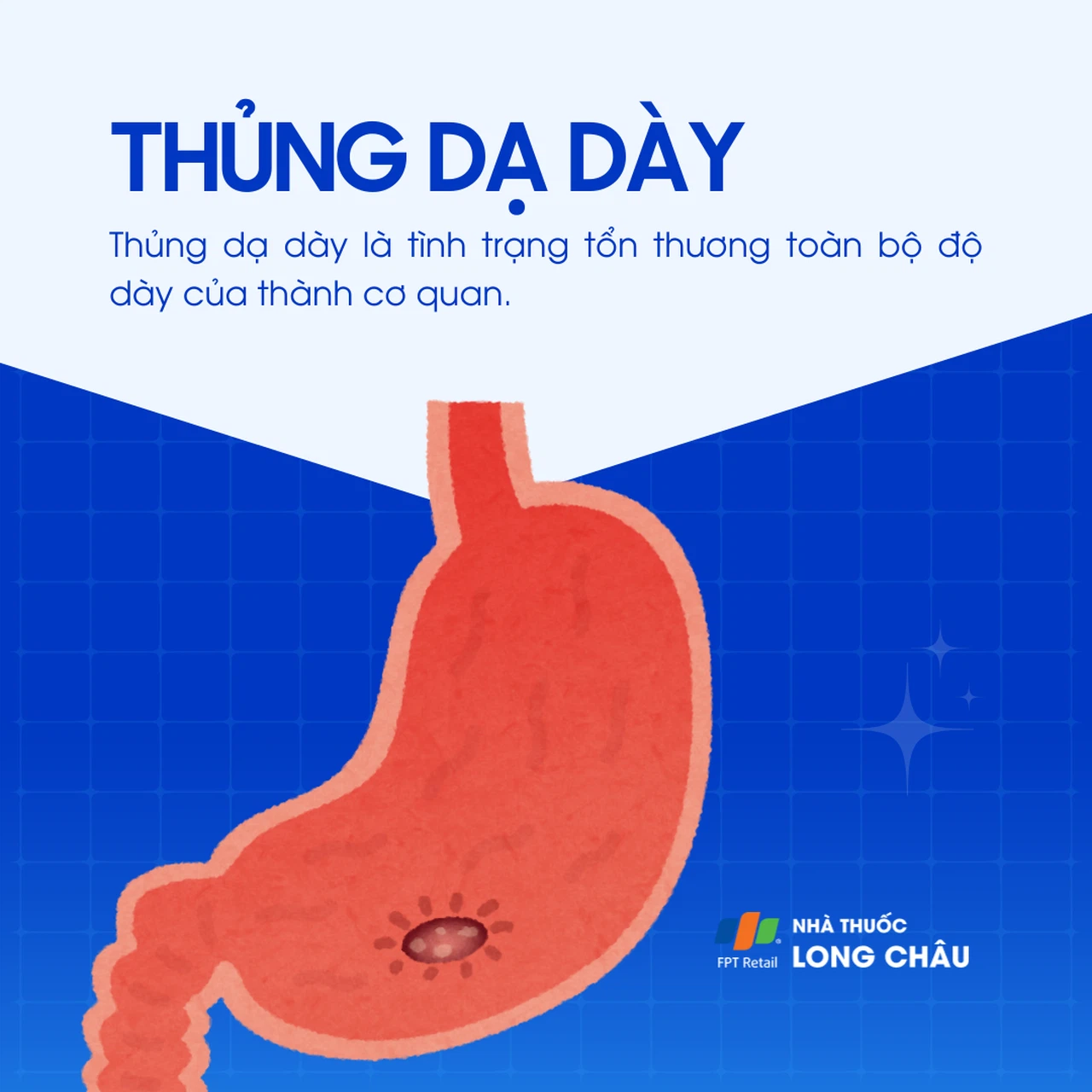 Thủng dạ dày 1
