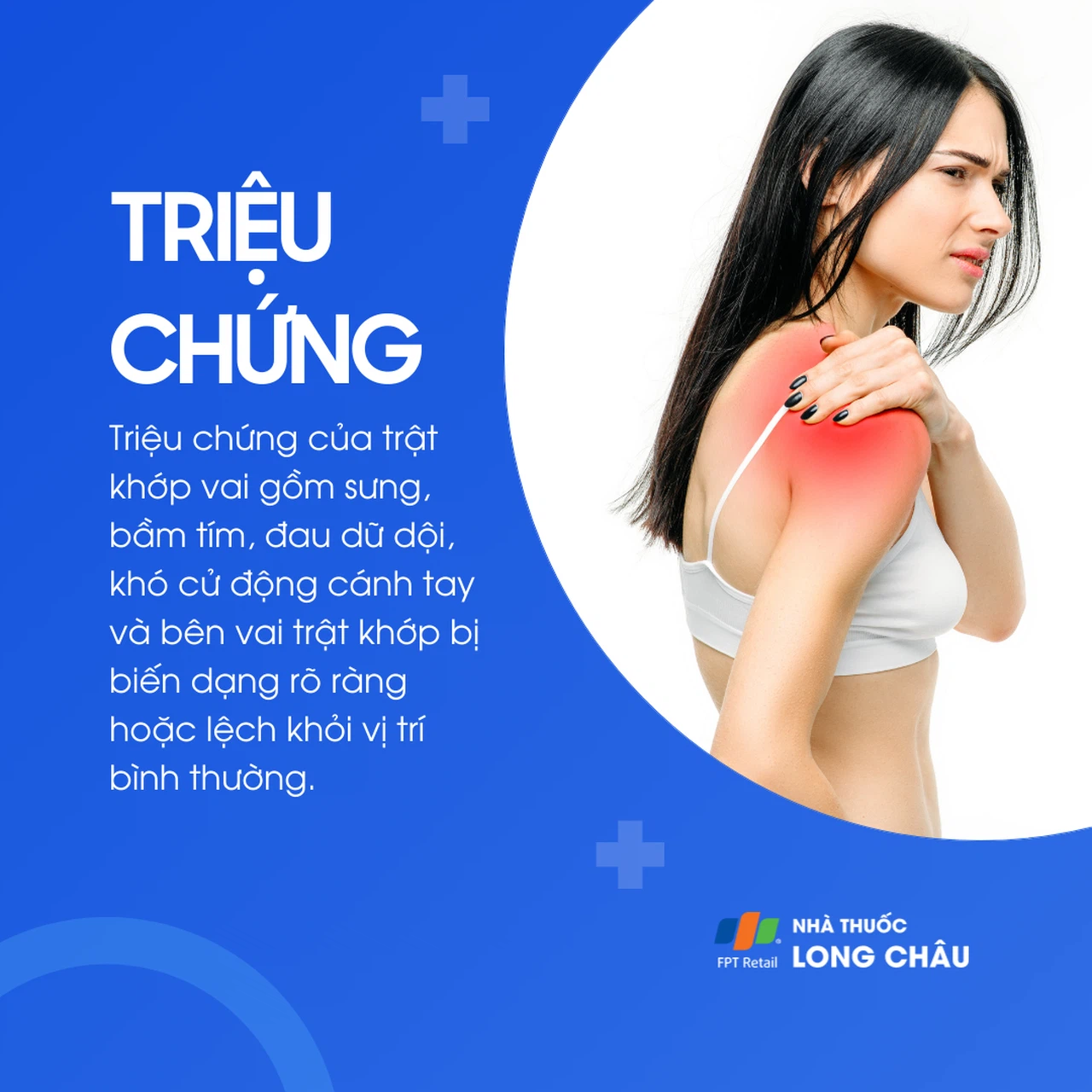 Trật khớp vai 2