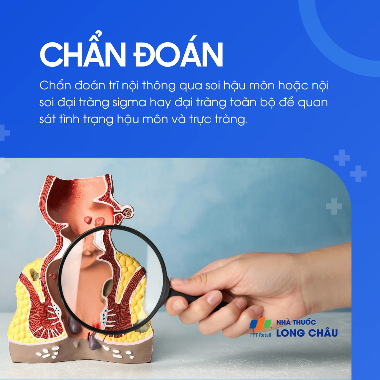 Trĩ nội 5