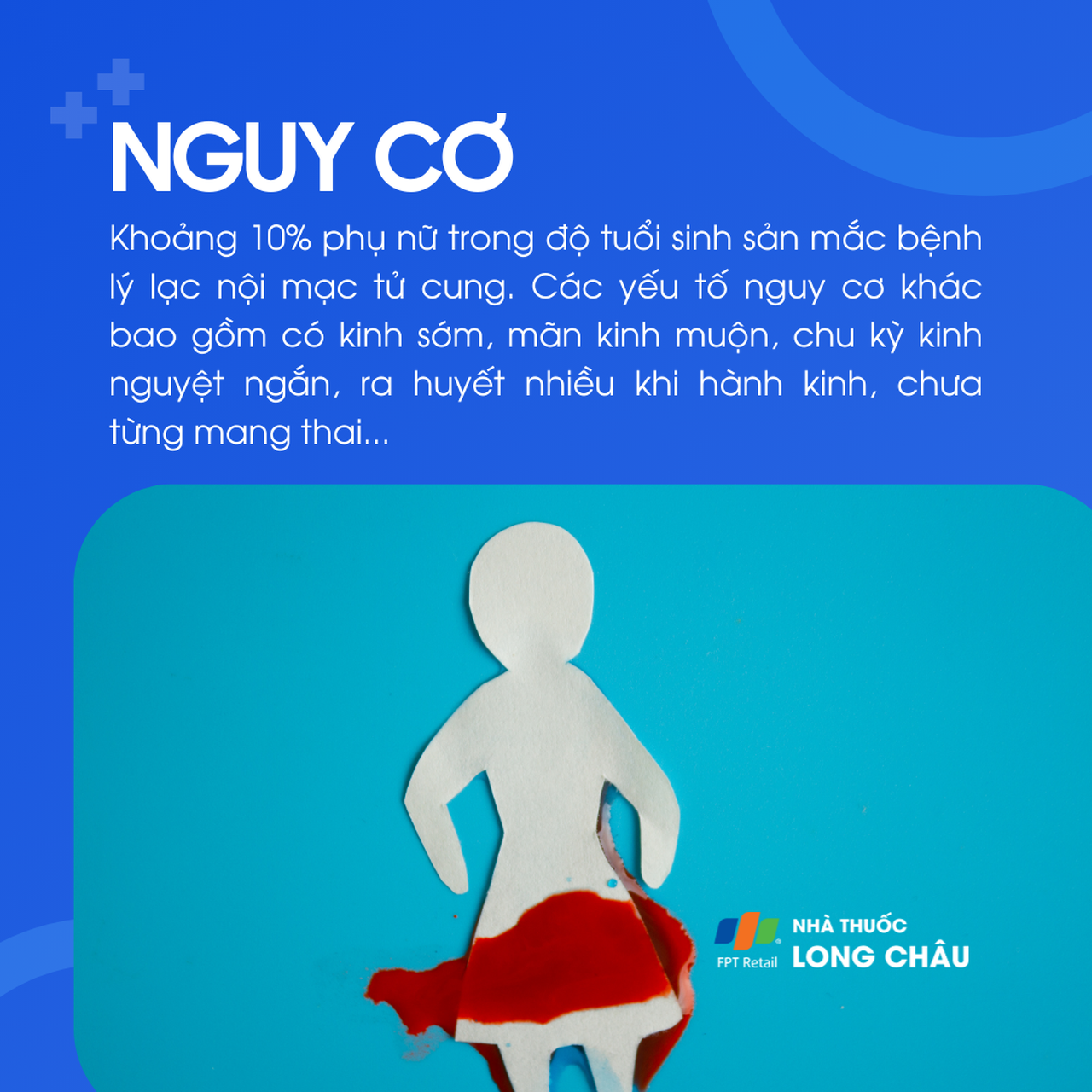 U lạc nội mạc tử cung 4