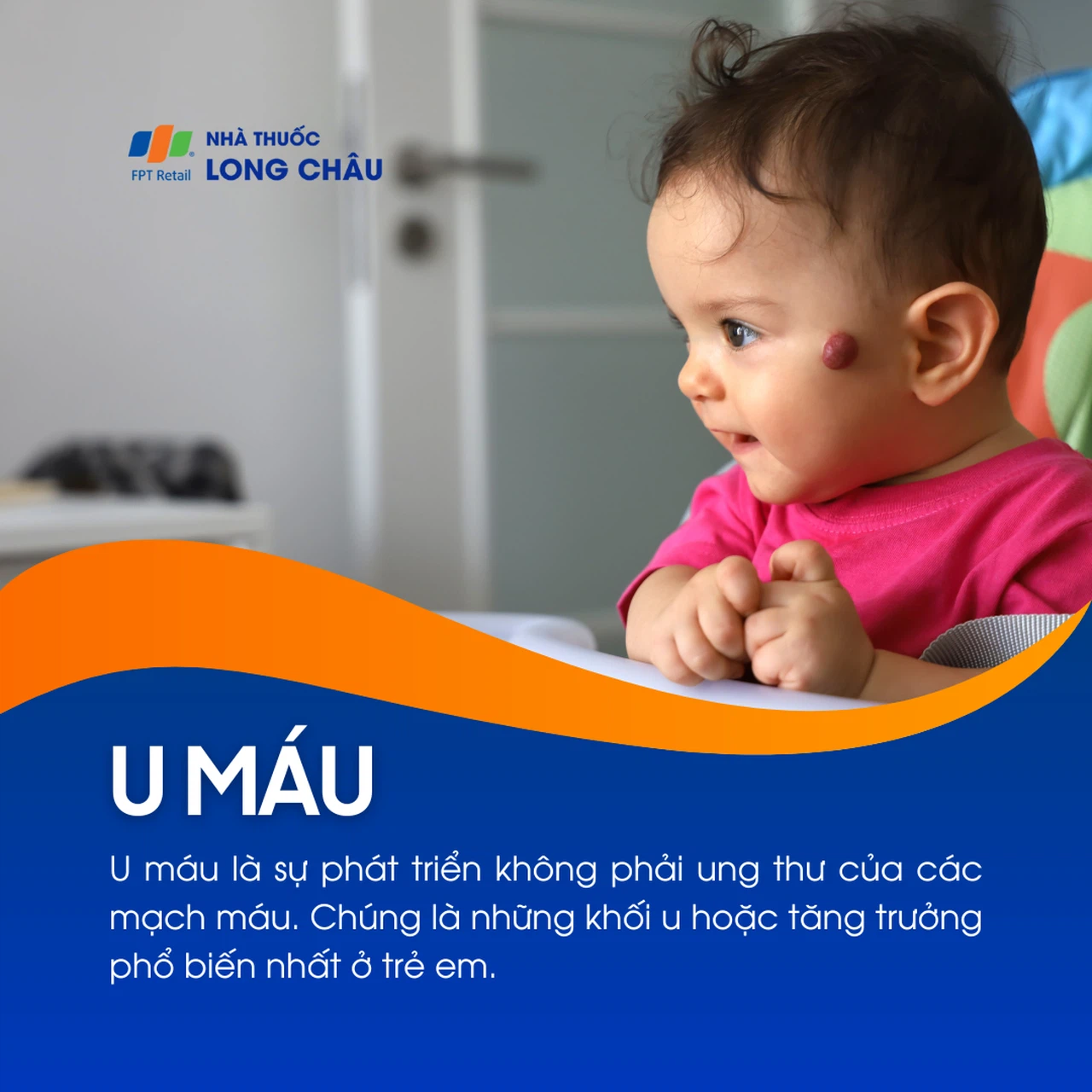 U máu 1