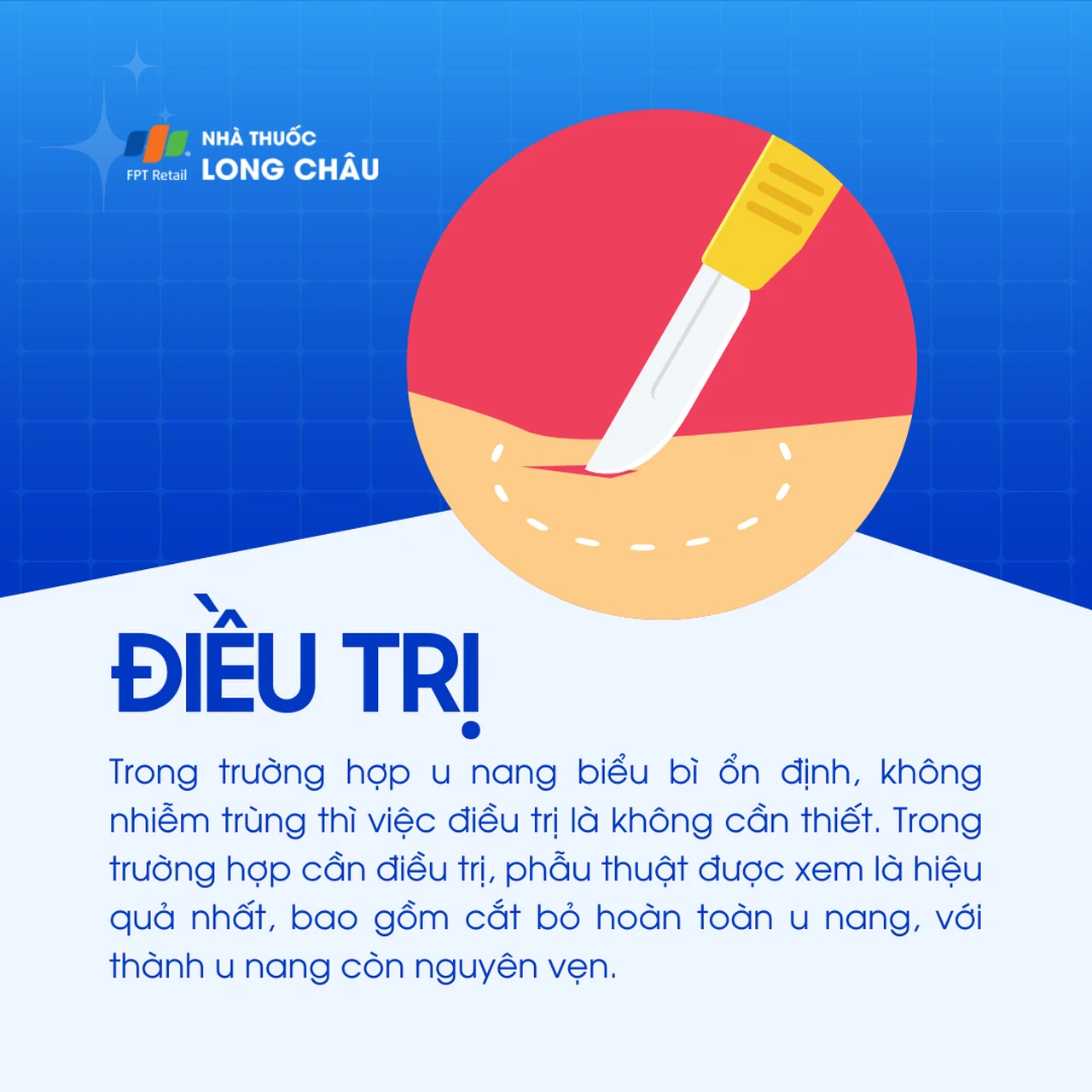 U nang biểu bì 6