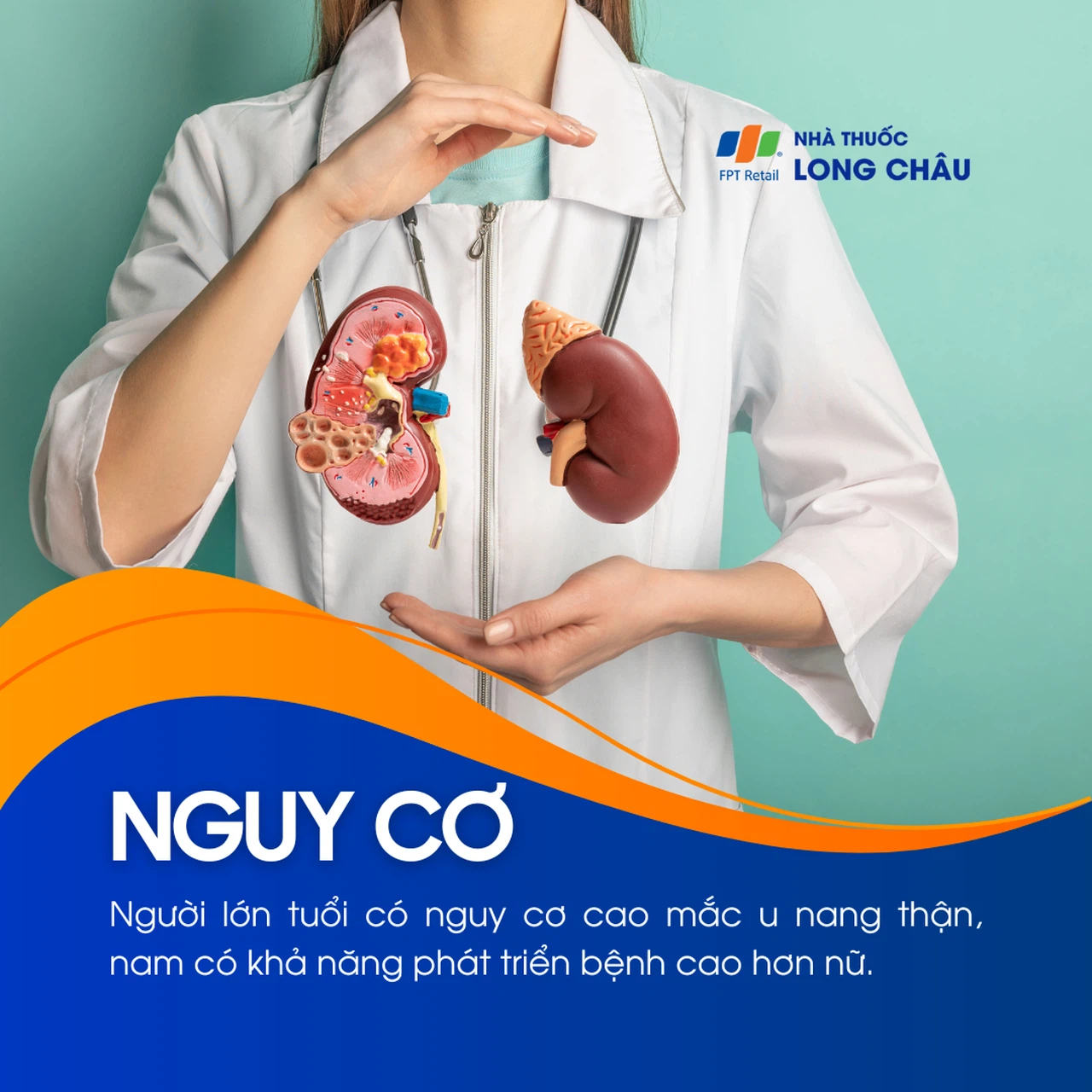 U nang thận 4