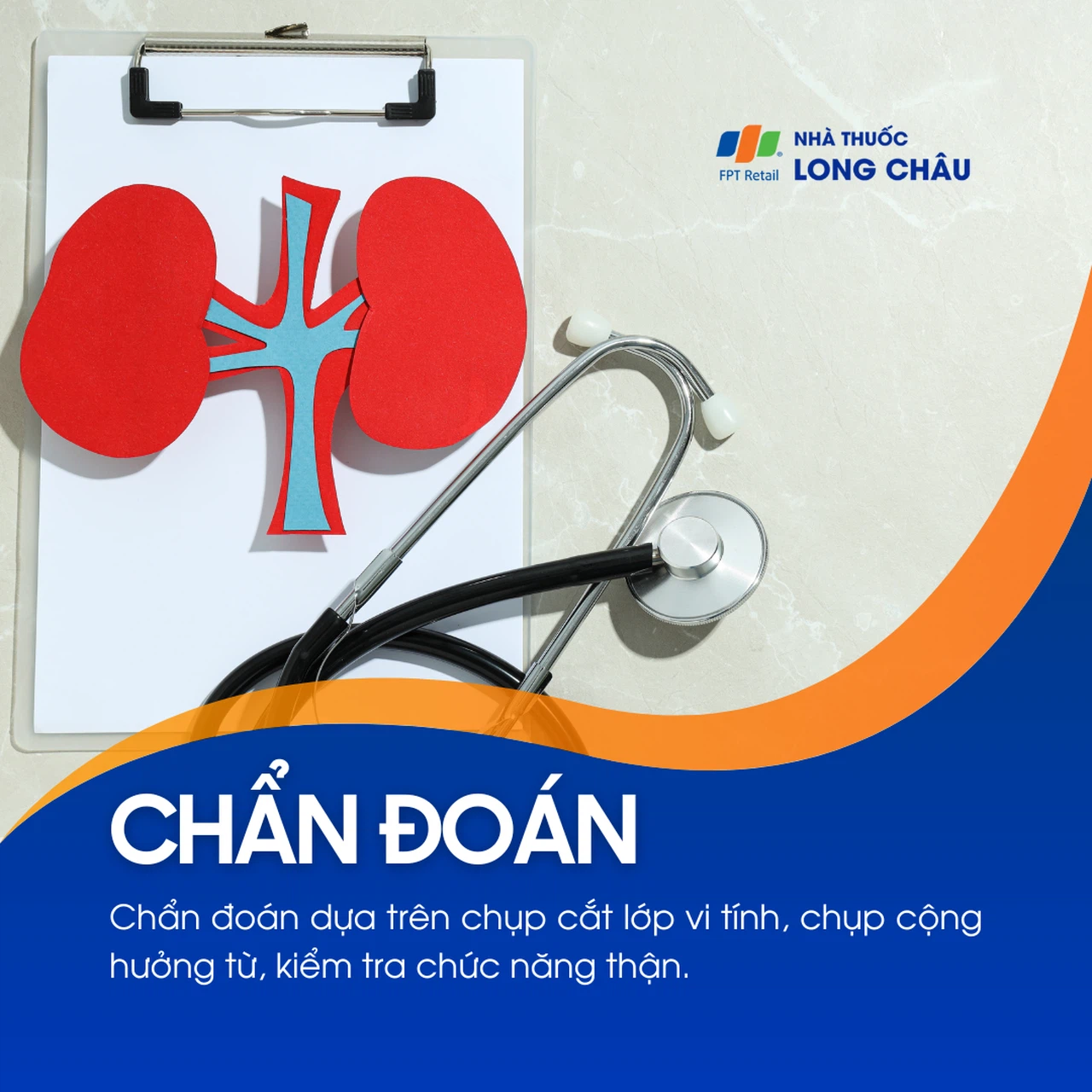 U nang thận 5