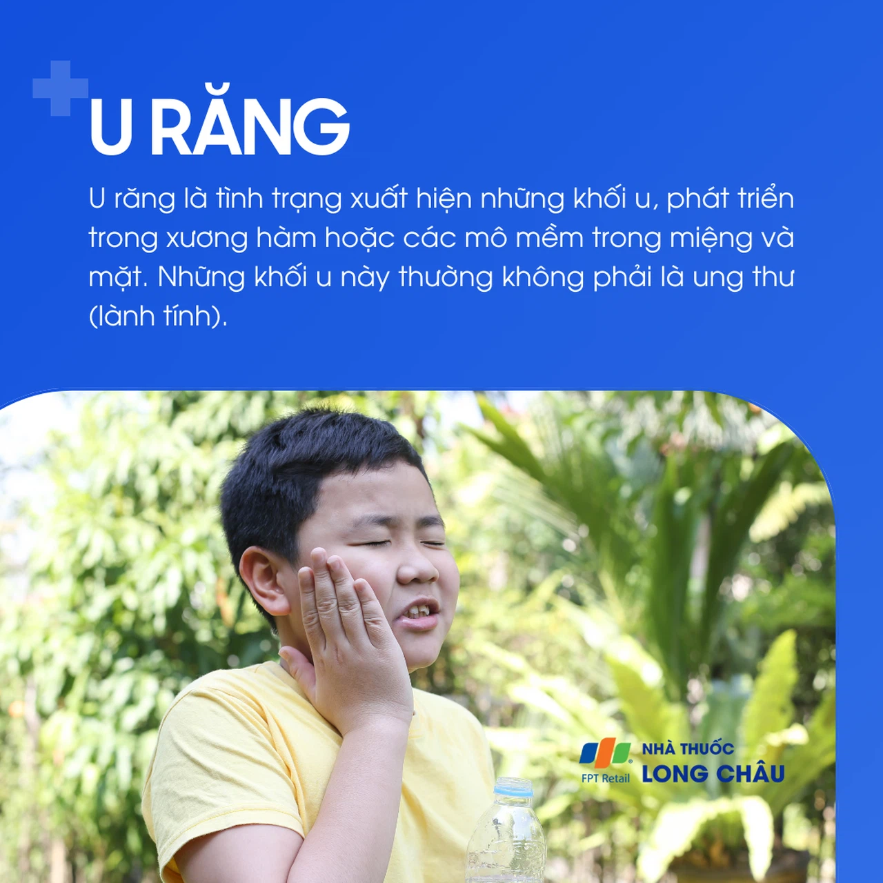 U răng 1