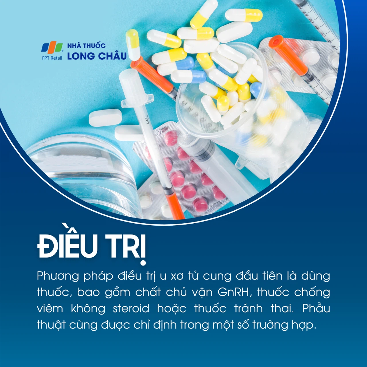 U xơ tử cung 6