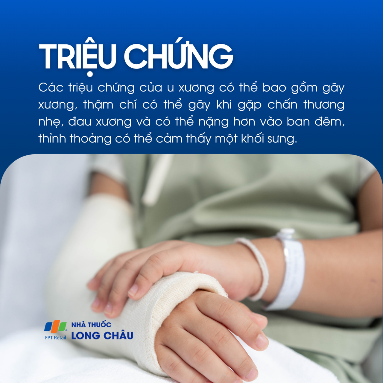 U xương 2