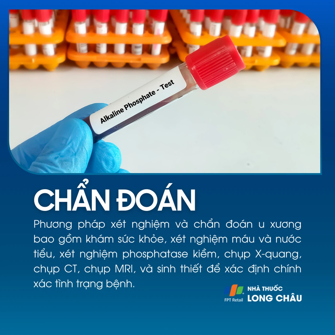 U xương 5