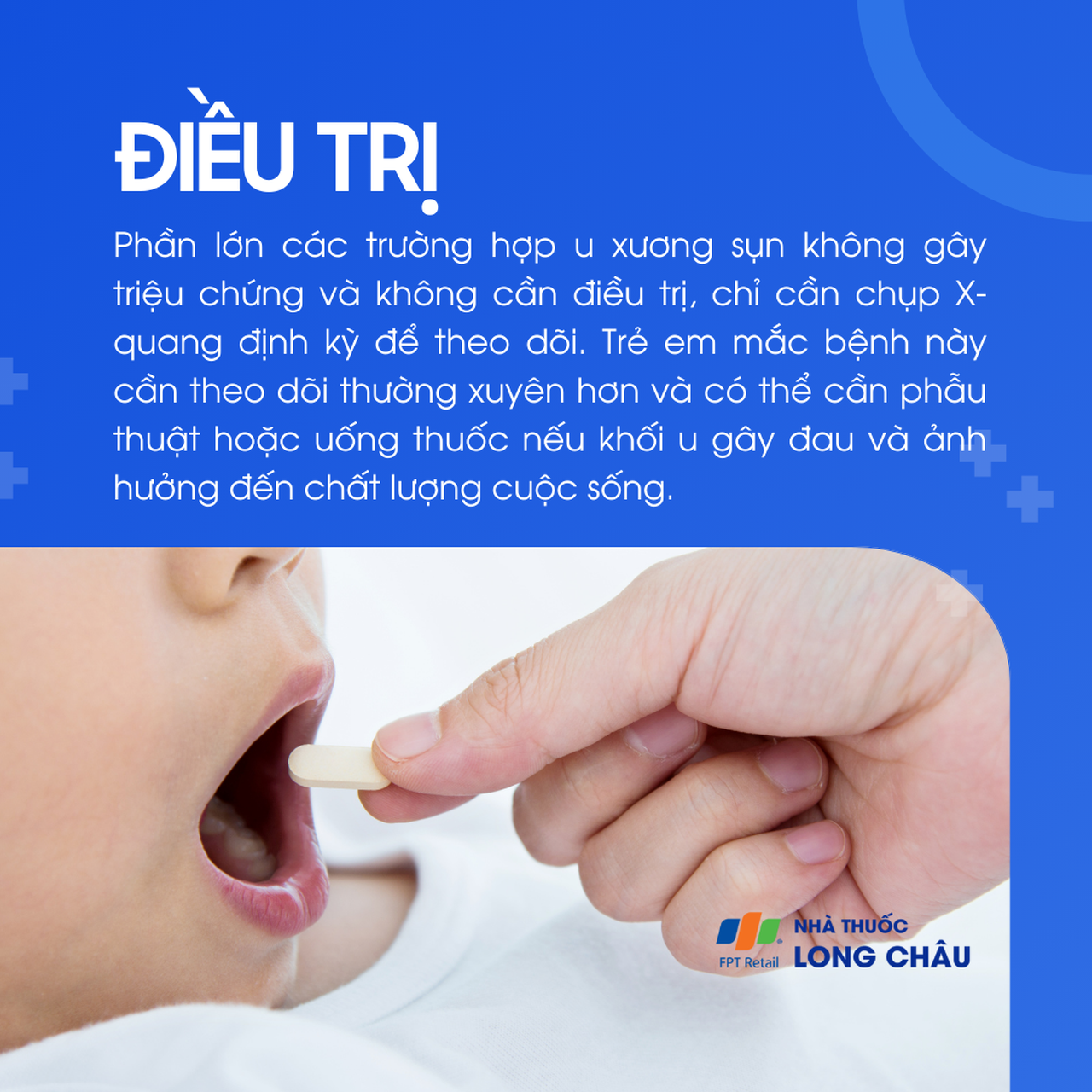 U xương sụn 6