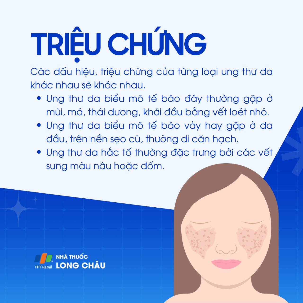 Ung thư da 2