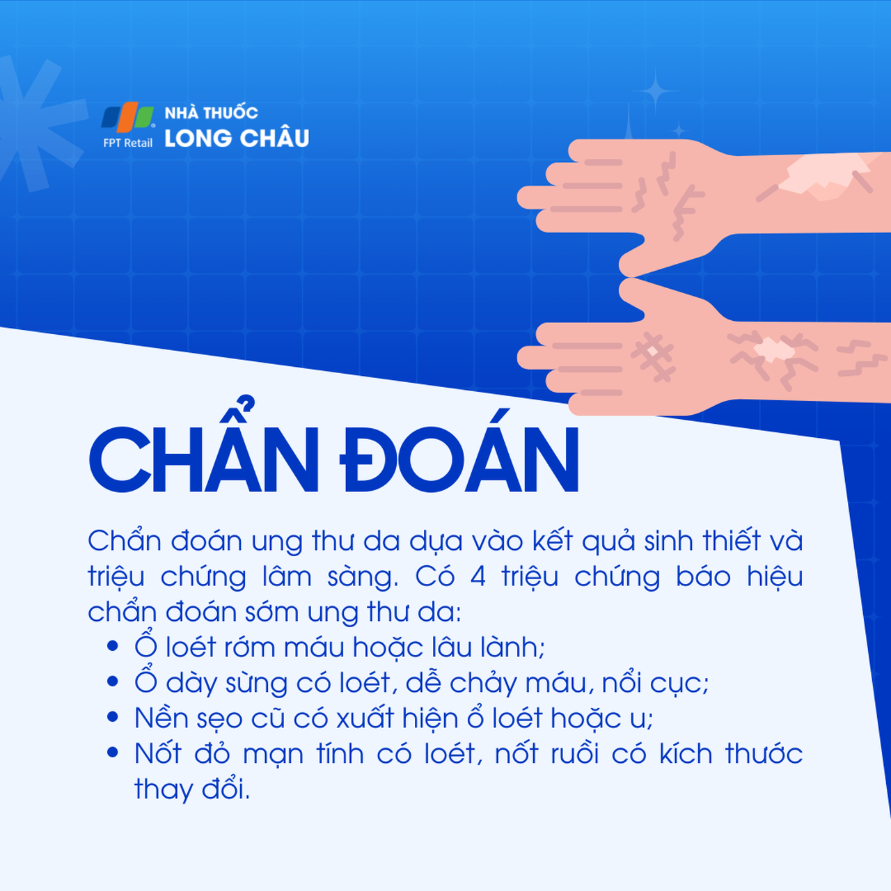 Ung thư da 5